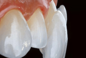 protetica dentara